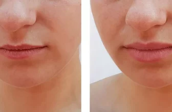 How Does Lip Care Change With Age?